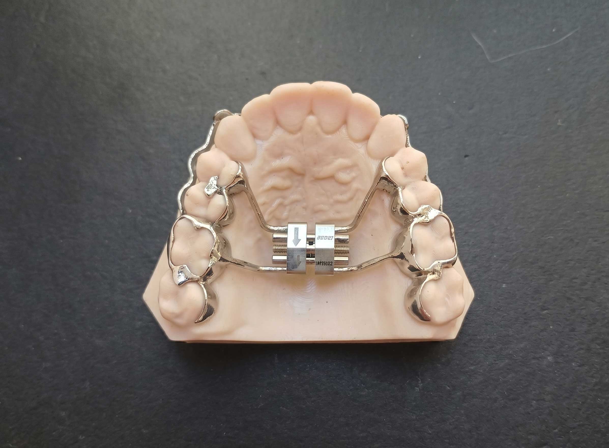 g2